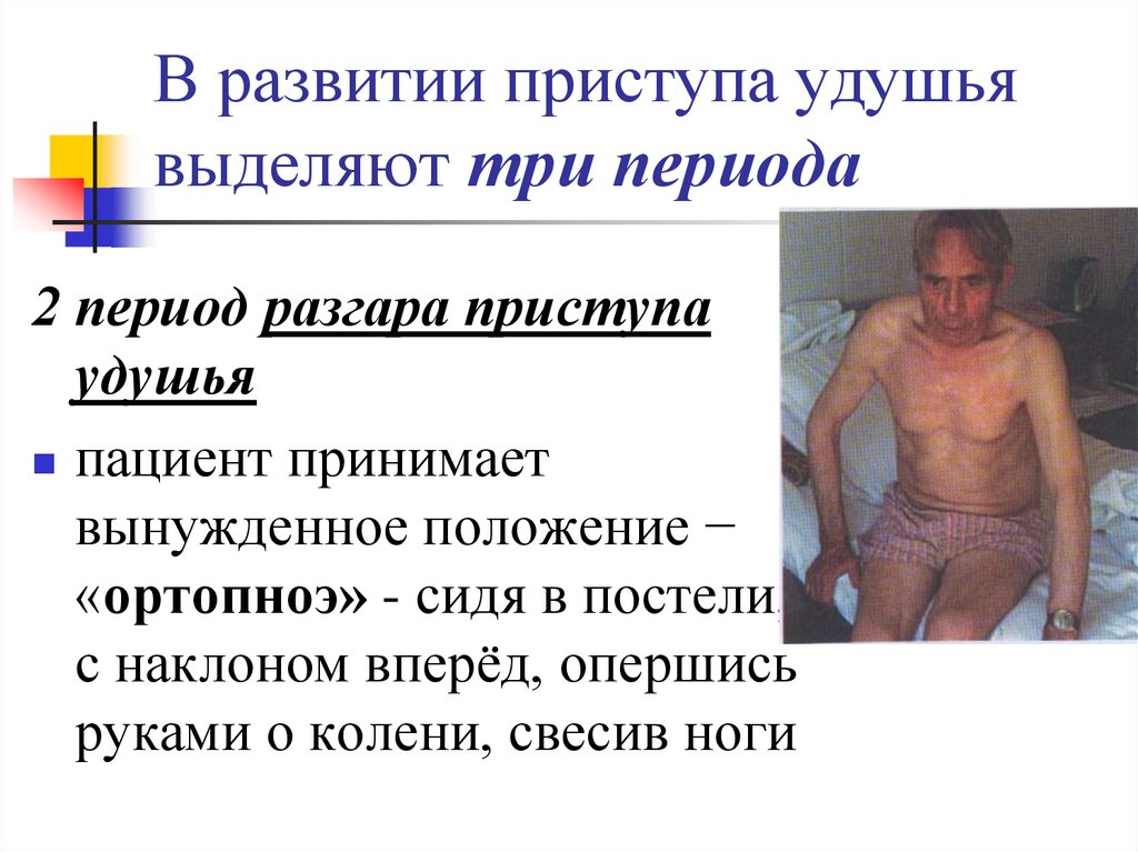 В развитии приступа удушья выделяют три периода