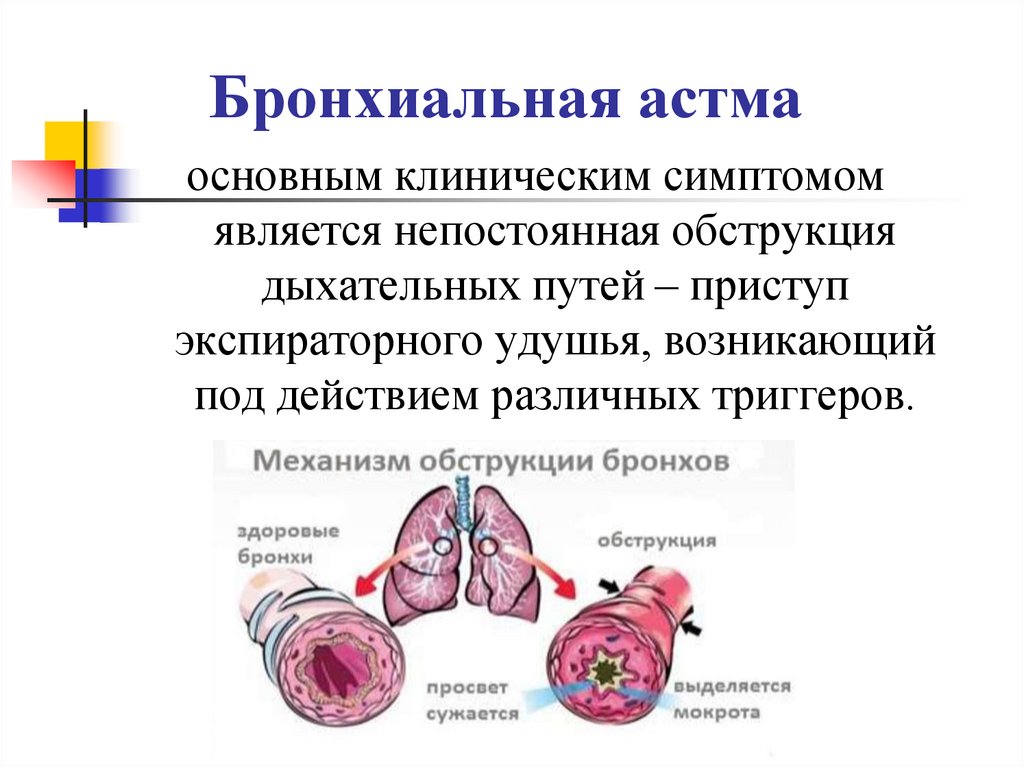Бронхиальная астма