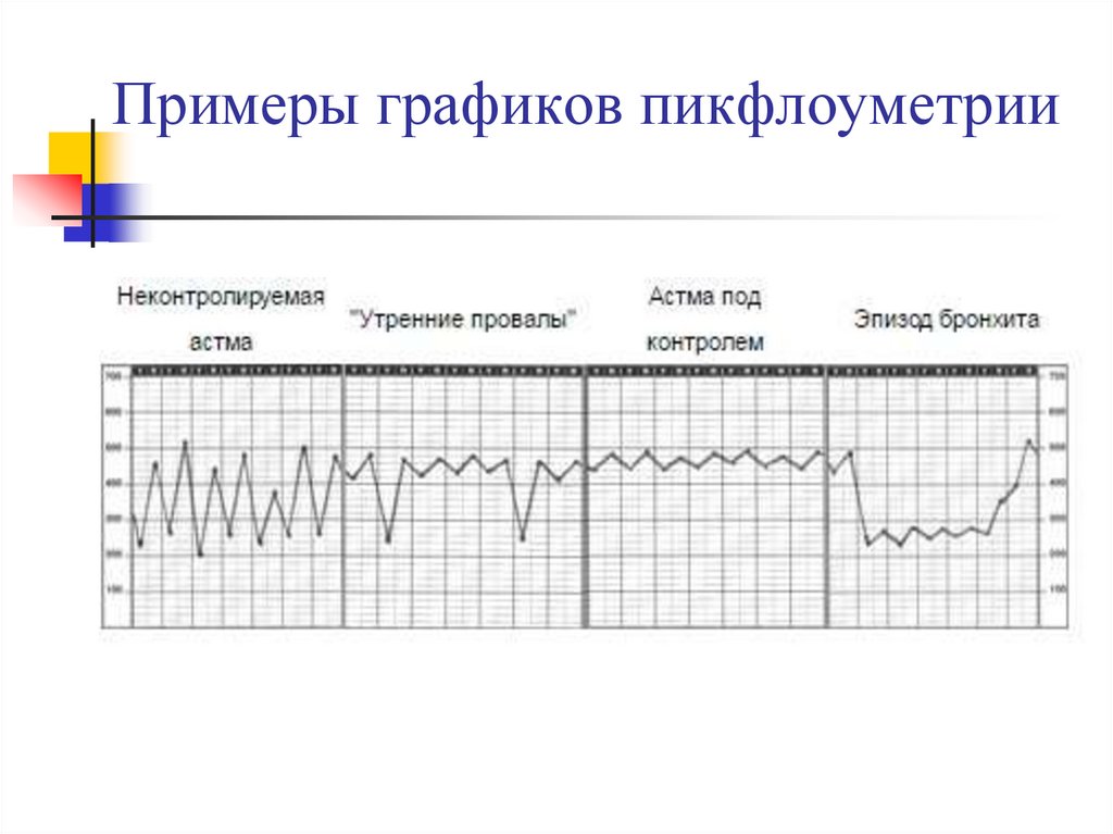 Примеры графиков пикфлоуметрии