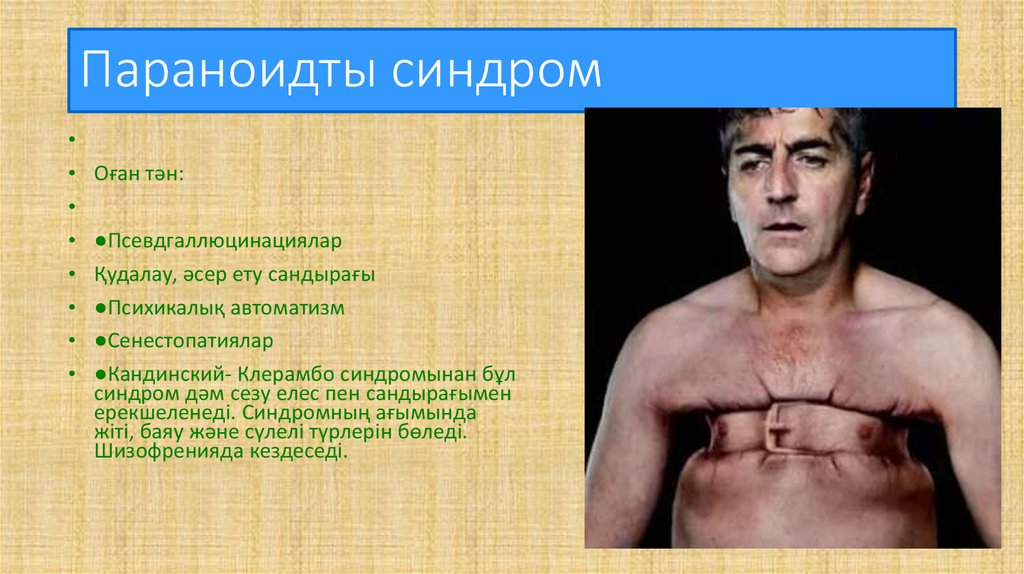 Параноидты синдром