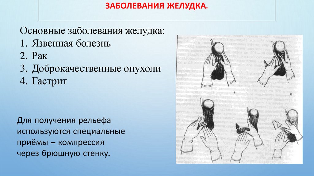 Заболевания желудка.