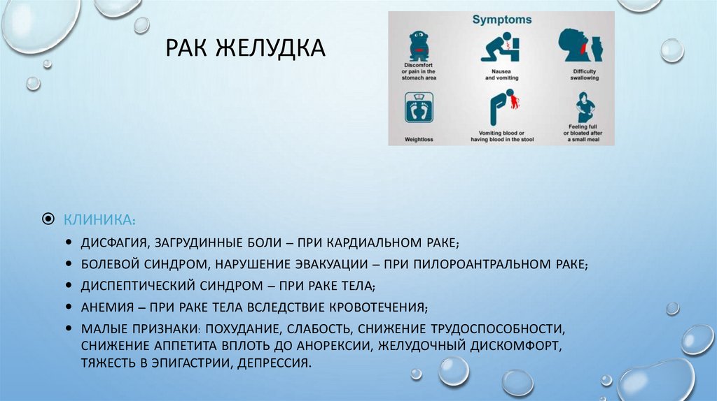 Рак желудка