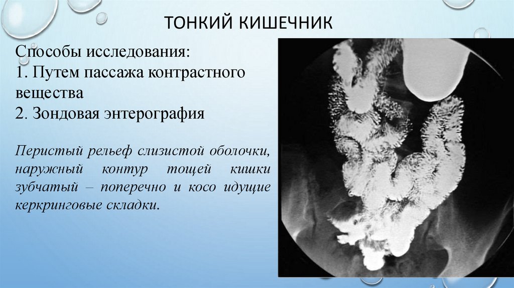 Тонкий кишечник