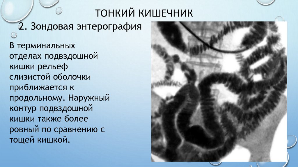 Тонкий кишечник