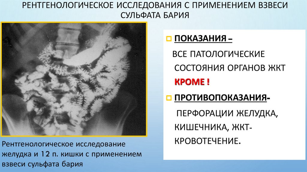 Рентгенологическое исследования с применением взвеси сульфата бария