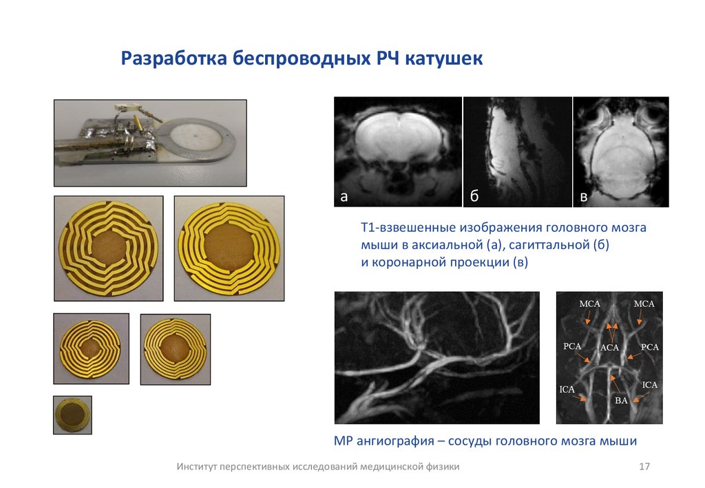 Разработка беспроводных РЧ катушек