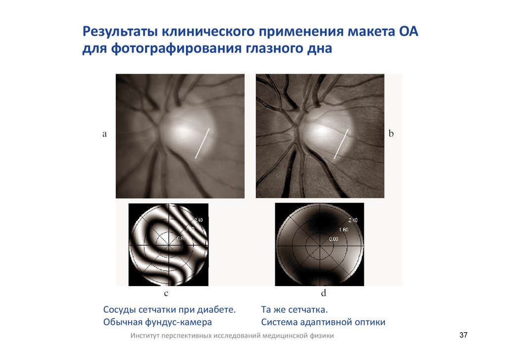 Результаты клинического применения макета ОА для фотографирования глазного дна