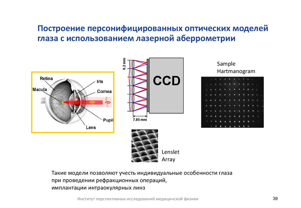 Построение персонифицированных оптических моделей глаза с использованием лазерной аберрометрии