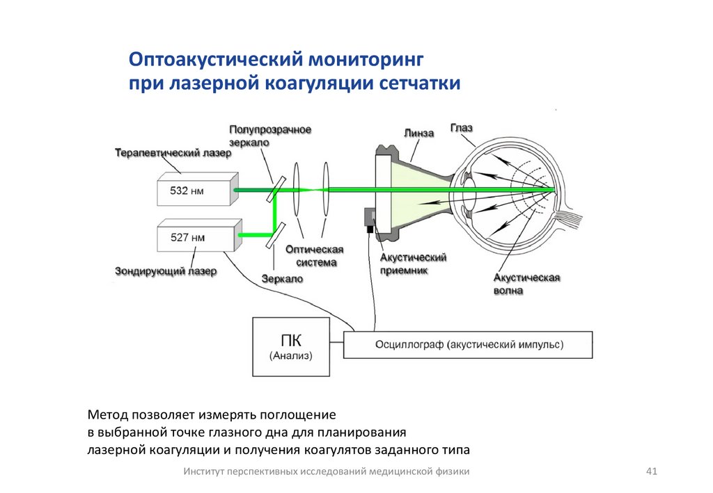 Оптоакустический мониторинг при лазерной коагуляции сетчатки