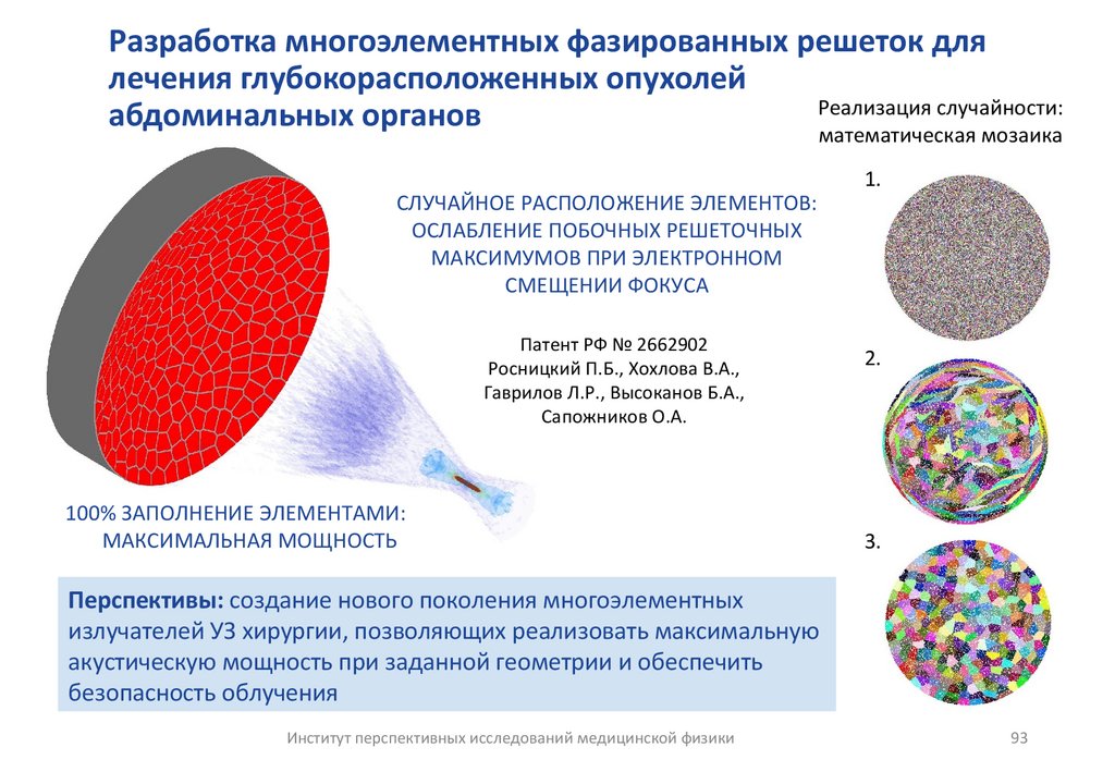 Разработка многоэлементных фазированных решеток для лечения глубокорасположенных опухолей абдоминальных органов