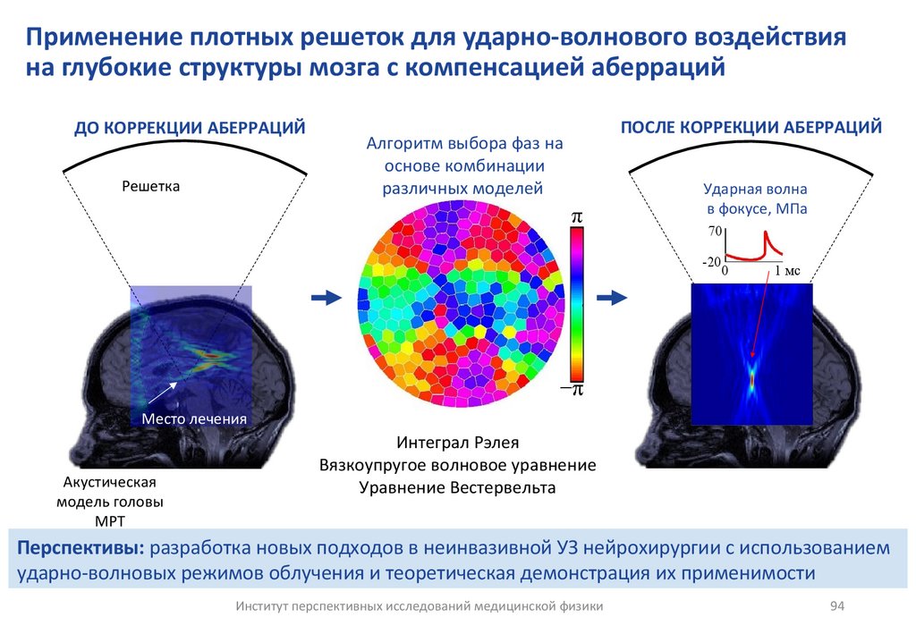 Применение плотных решеток для ударно-волнового воздействия на глубокие структуры мозга с компенсацией аберраций