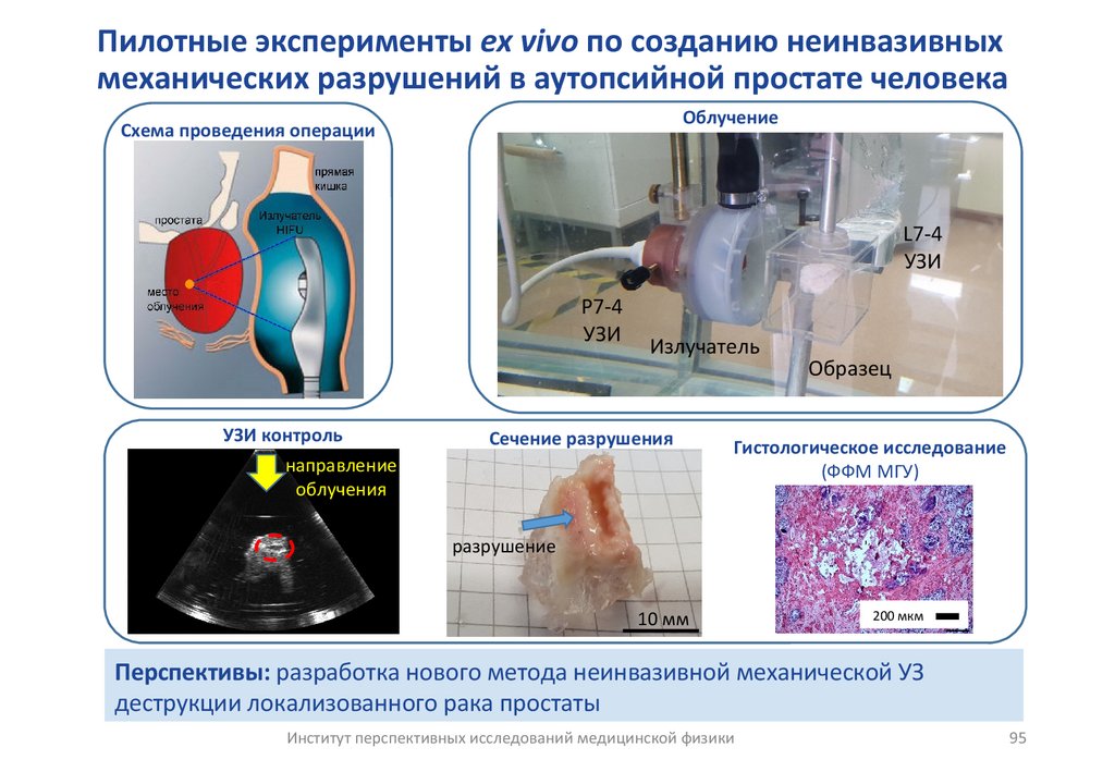 Пилотные эксперименты ex vivo по созданию неинвазивных механических разрушений в аутопсийной простате человека