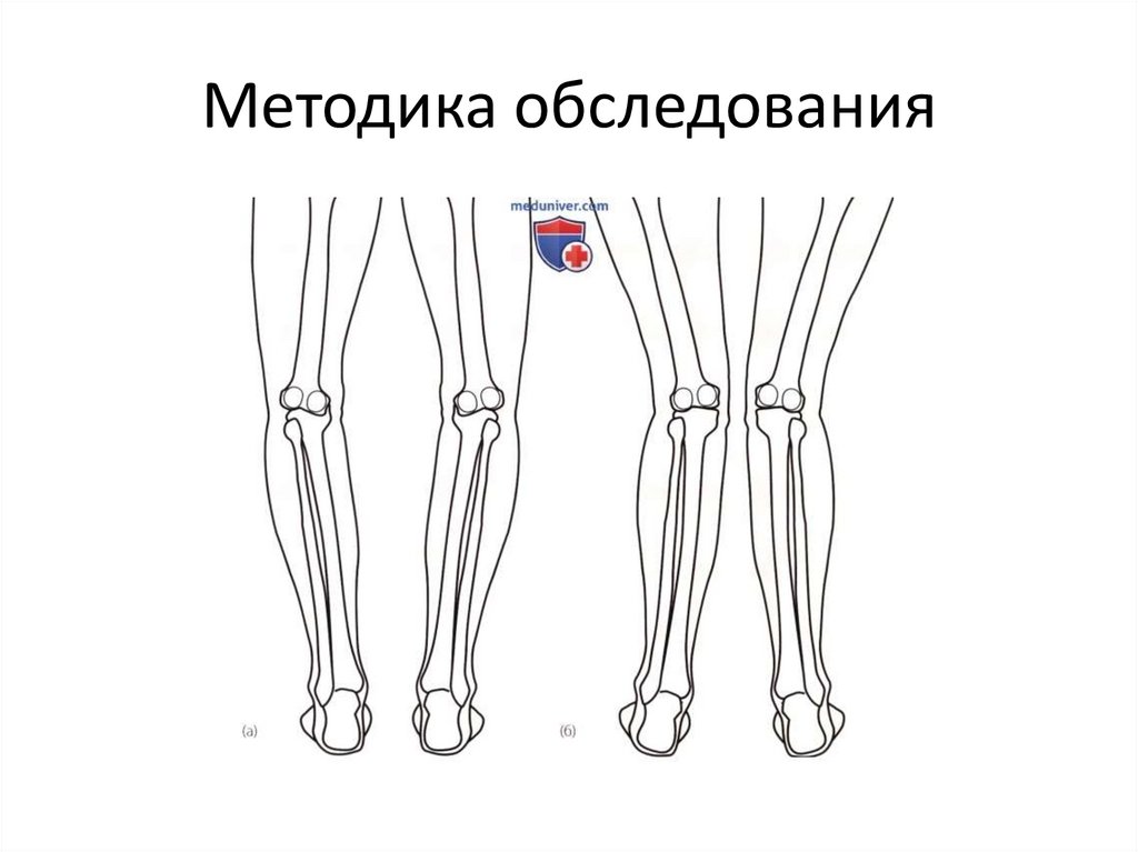 Методика обследования