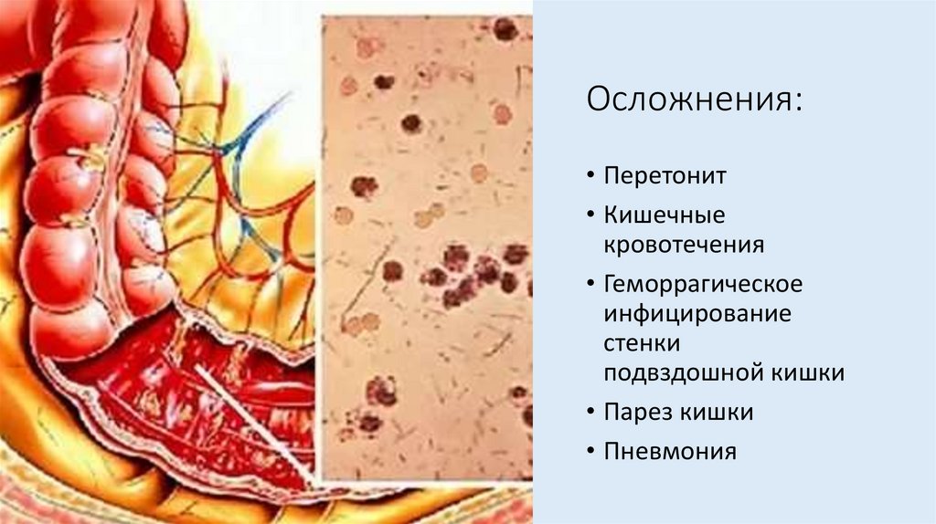 Осложнения: