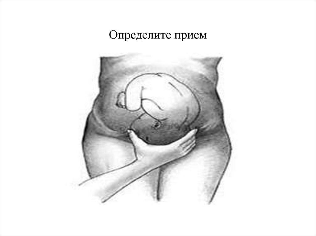 Определите прием