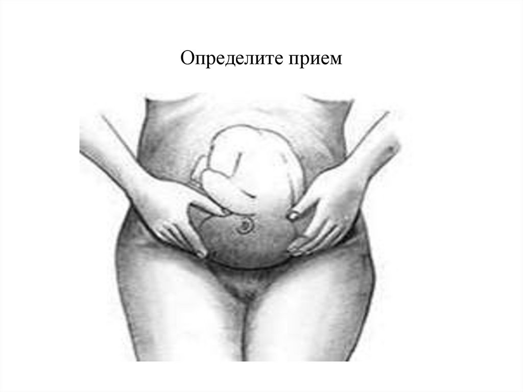 Определите прием