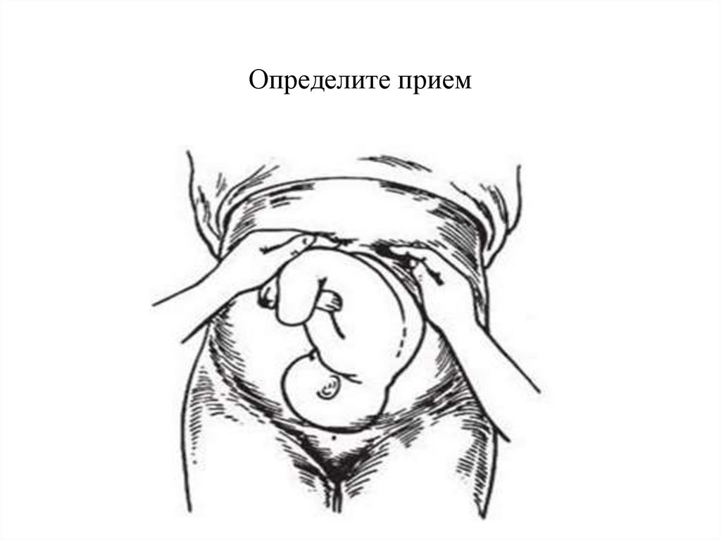 Определите прием