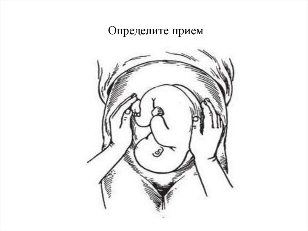 Определите прием