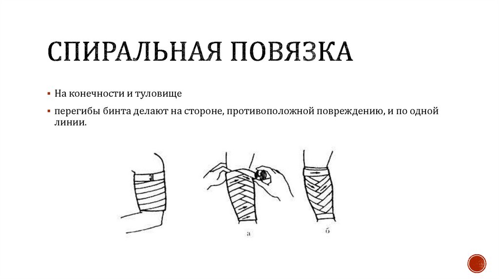 Спиральная повязка