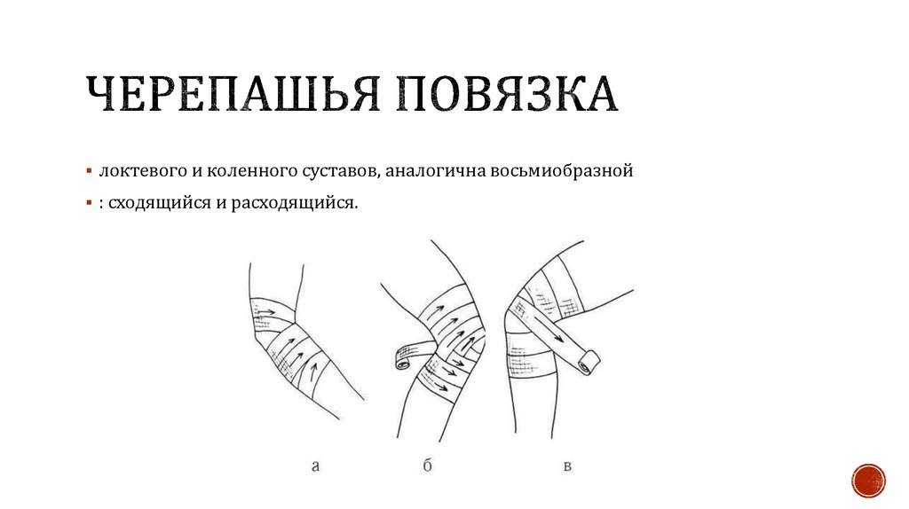 Черепашья повязка