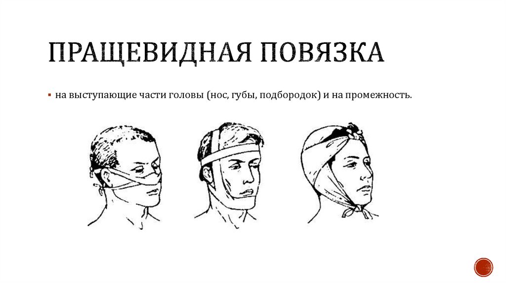 Пращевидная повязка