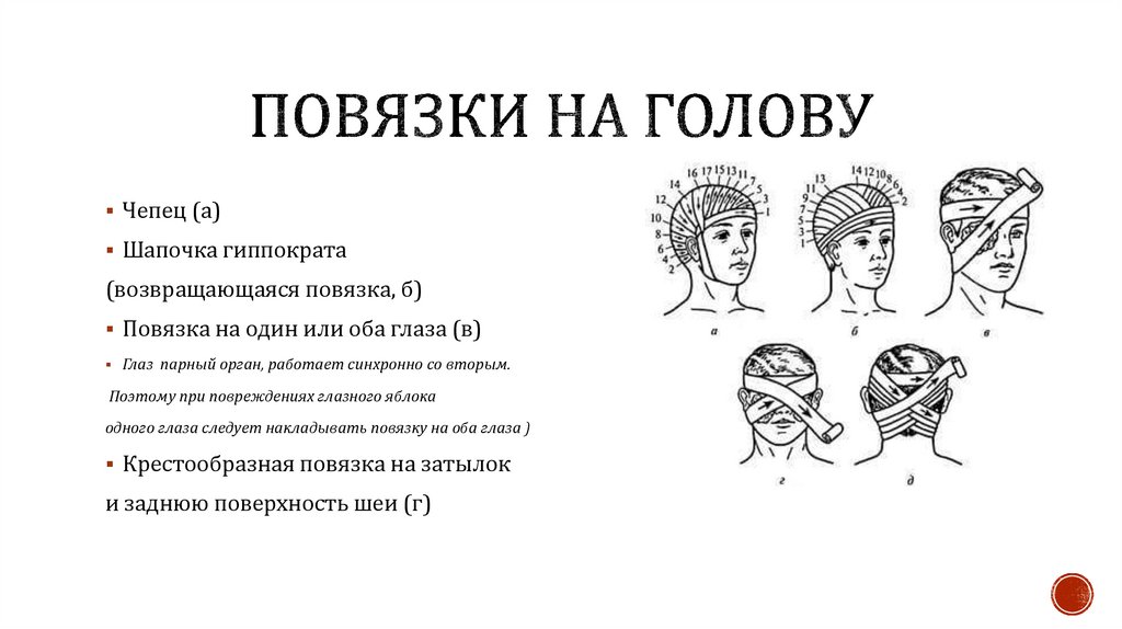 Повязки на голову