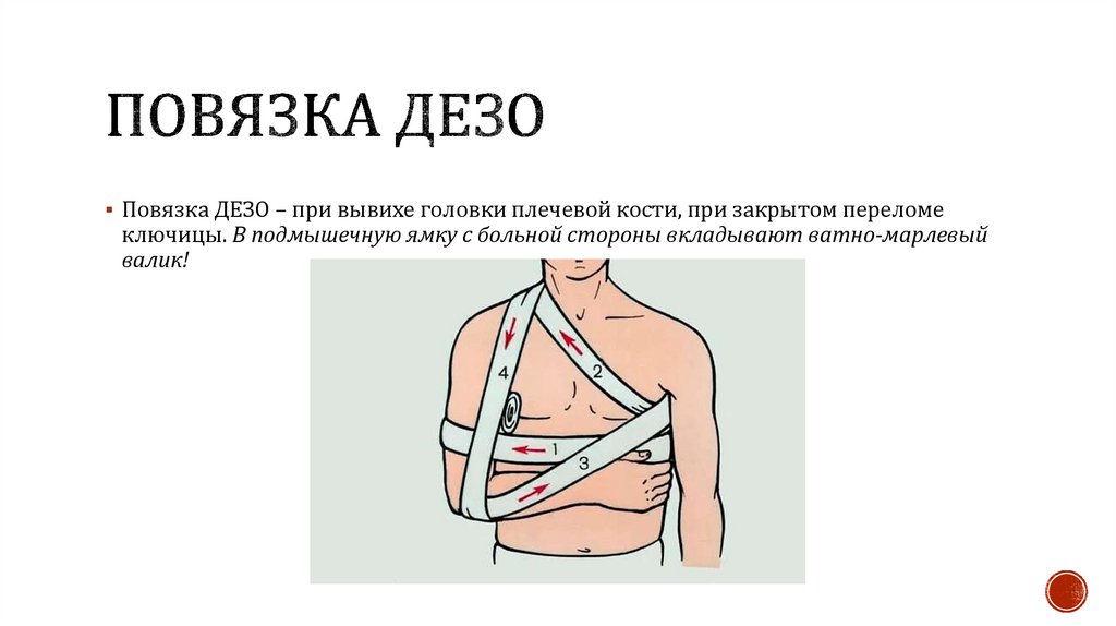 Повязка дезо