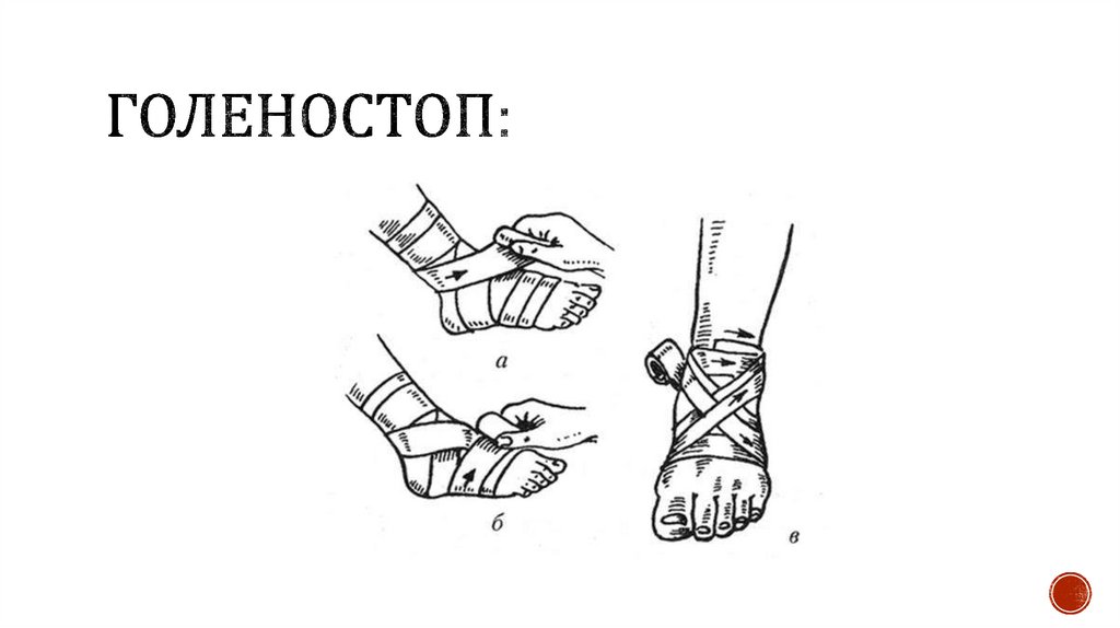 Голеностоп: