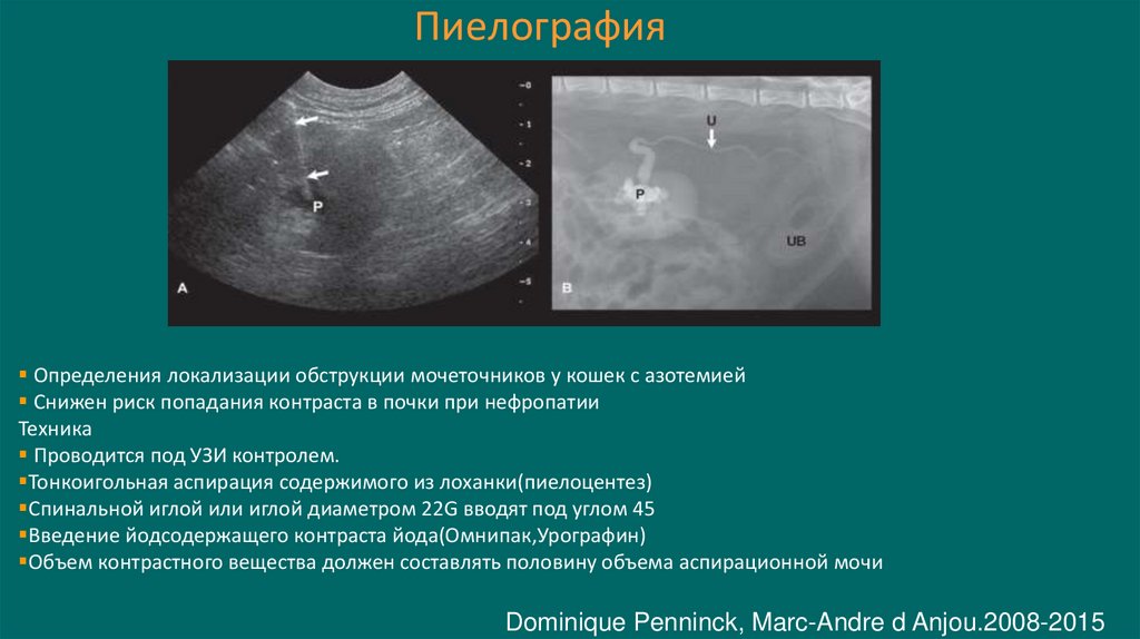 Пиелография