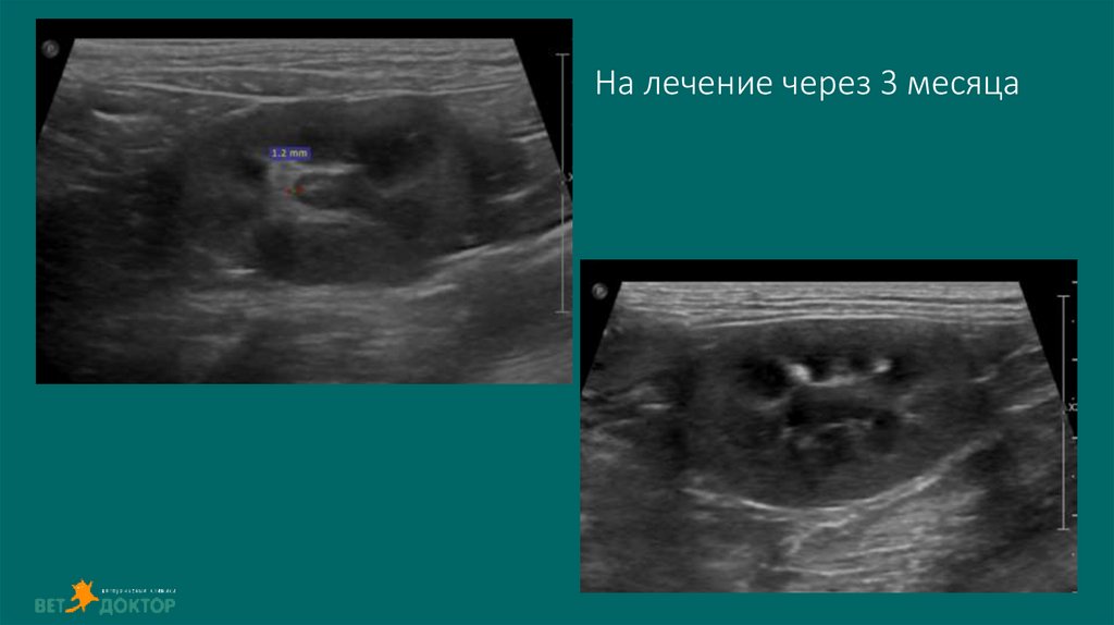 На лечение через 3 месяца