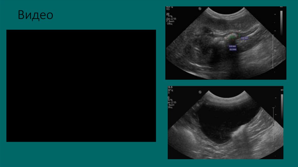 Видео