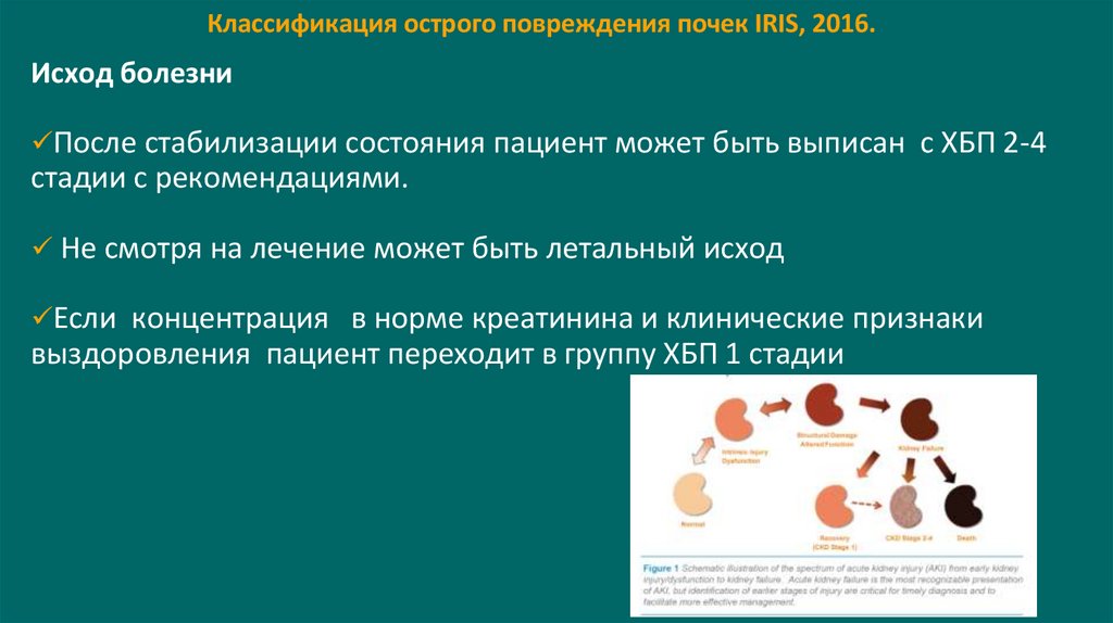 Классификация острого повреждения почек IRIS, 2016.