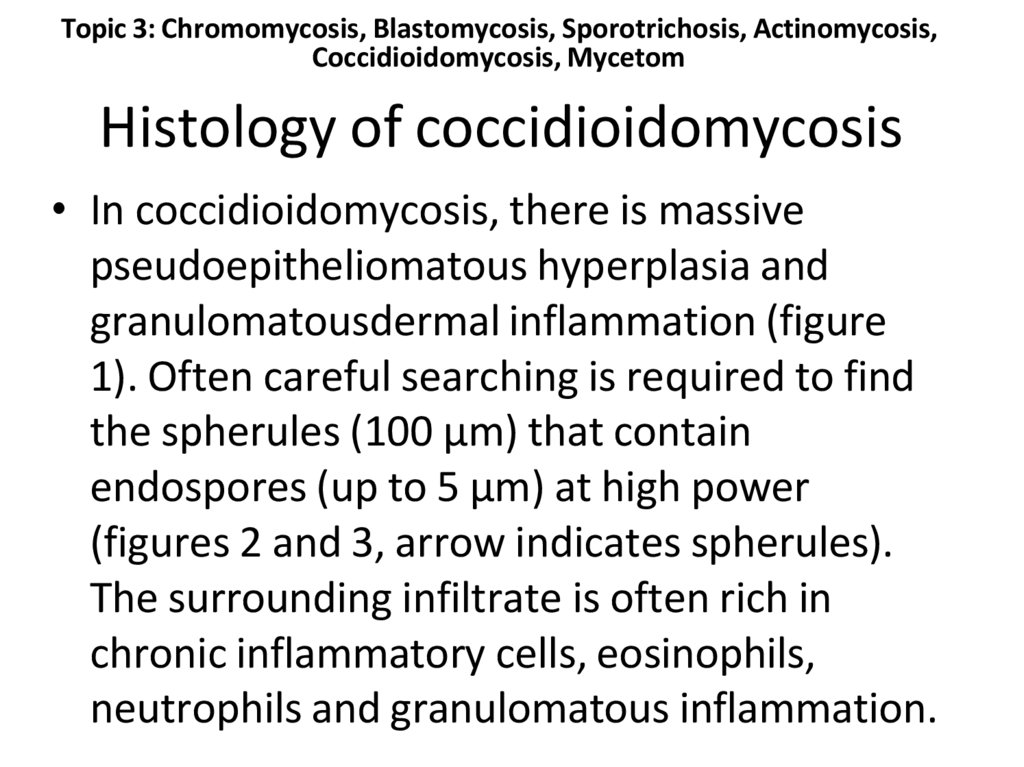 Histology of coccidioidomycosis