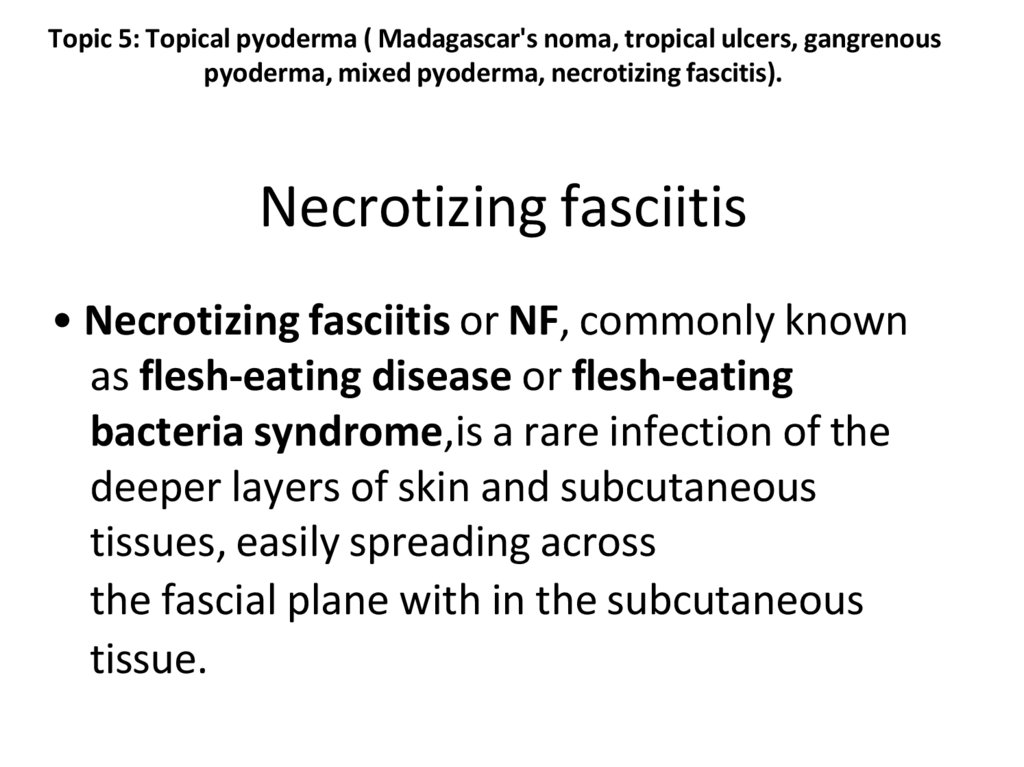 Necrotizing fasciitis