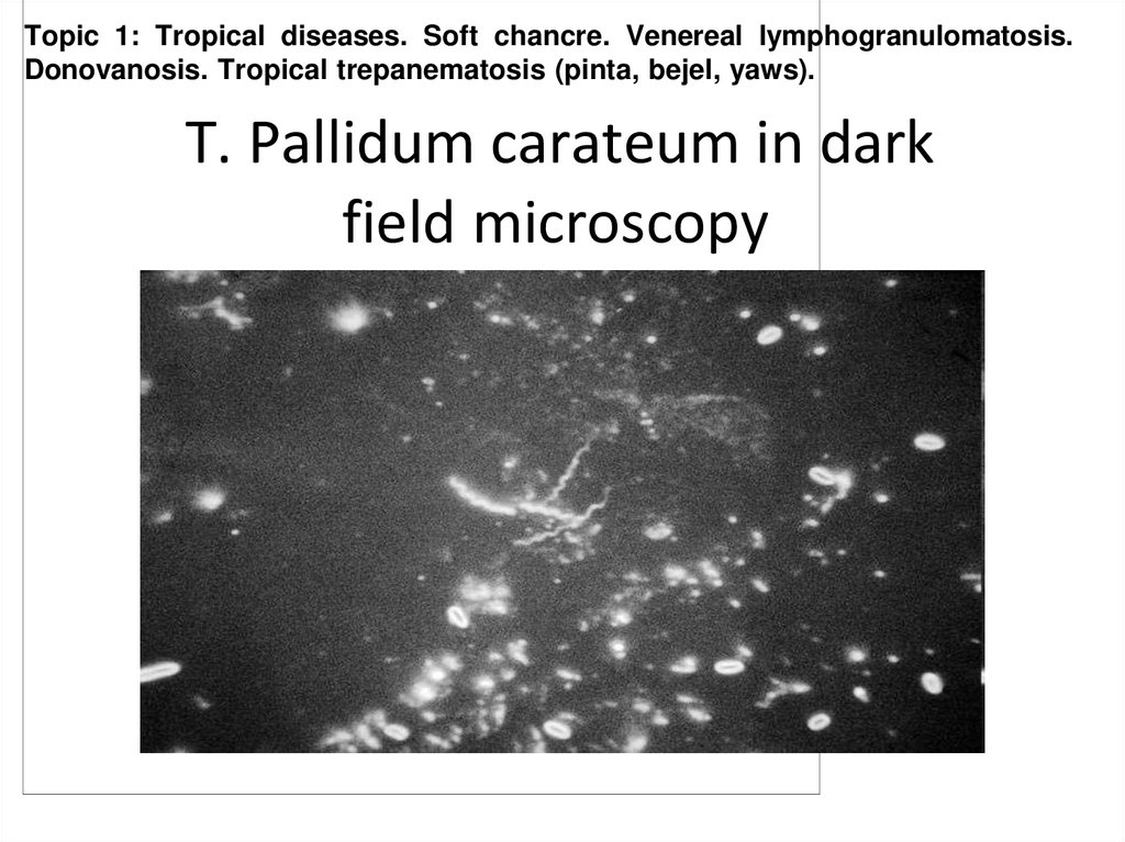 T. Pallidum carateum in dark field microscopy