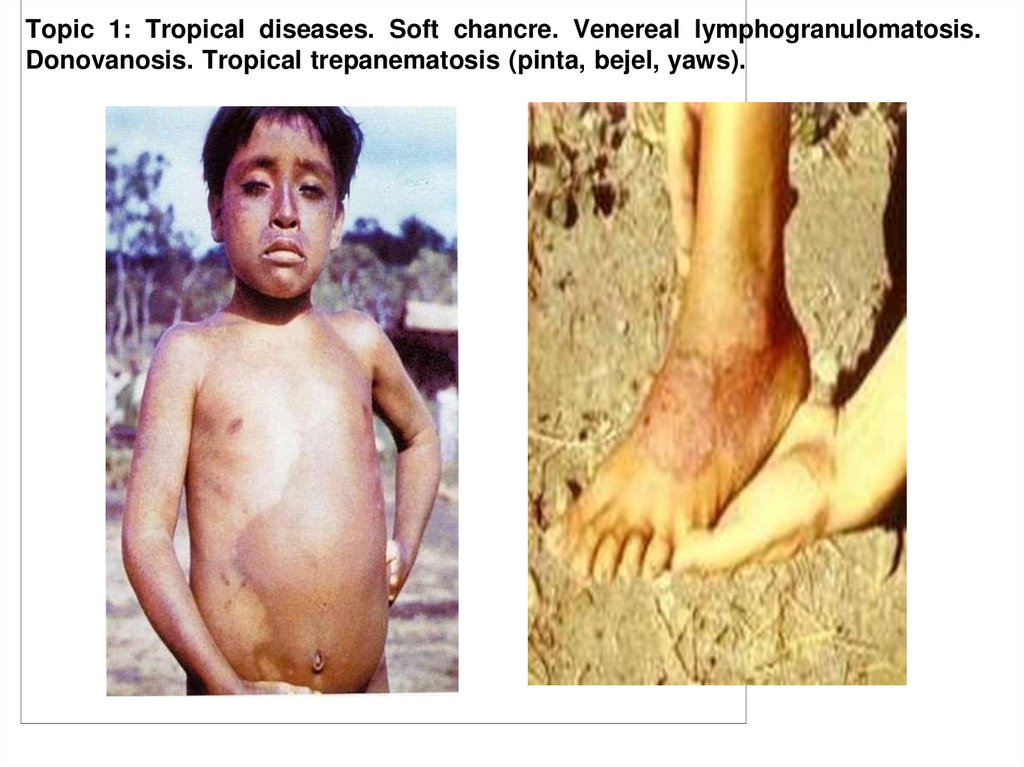 Pinta in different stages