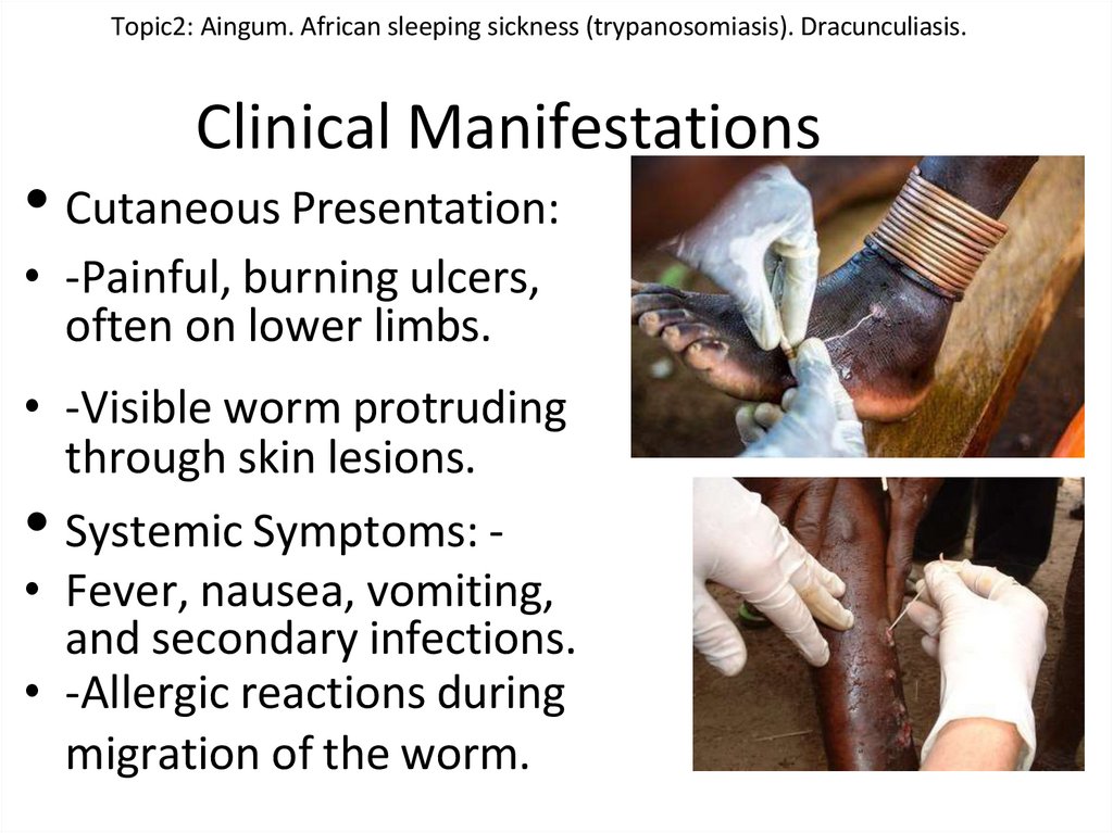 Clinical Manifestations