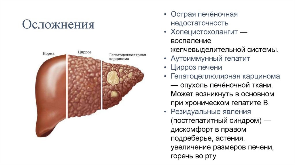 Осложнения