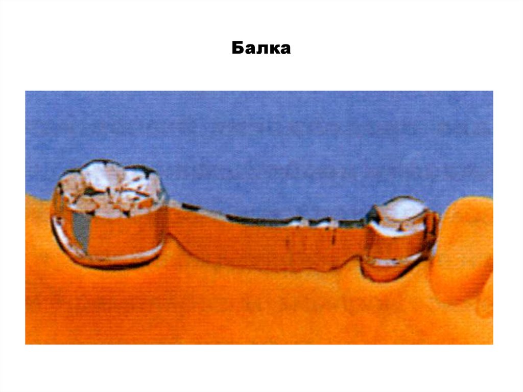 Балка