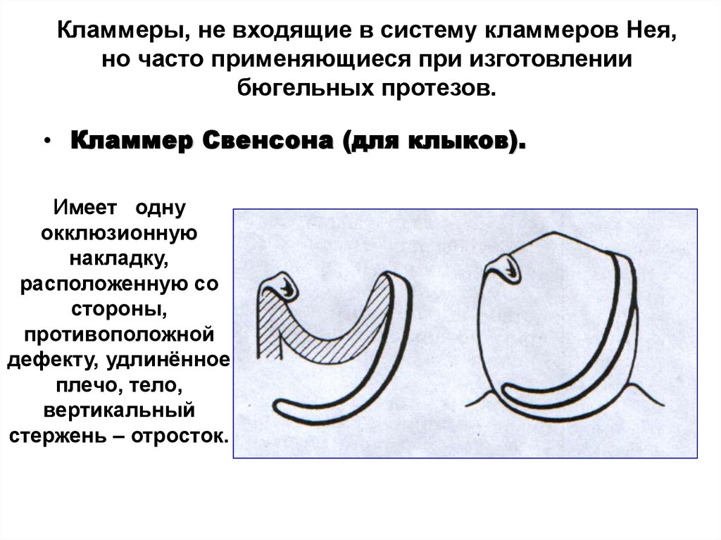 Кламмеры, не входящие в систему кламмеров Нея, но часто применяющиеся при изготовлении бюгельных протезов.
