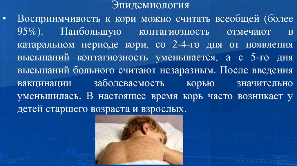 Эпидемиология