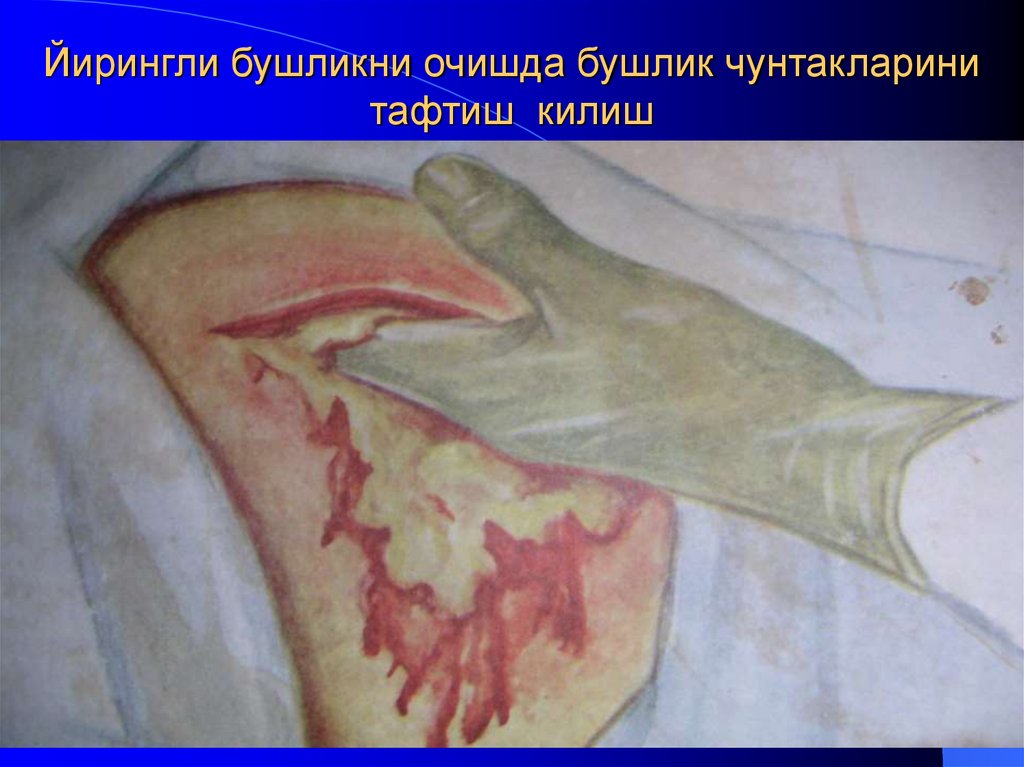 Йирингли бушликни очишда бушлик чунтакларини тафтиш килиш