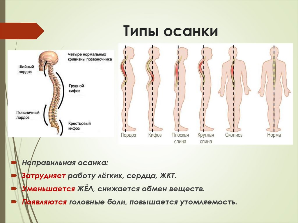 Типы осанки