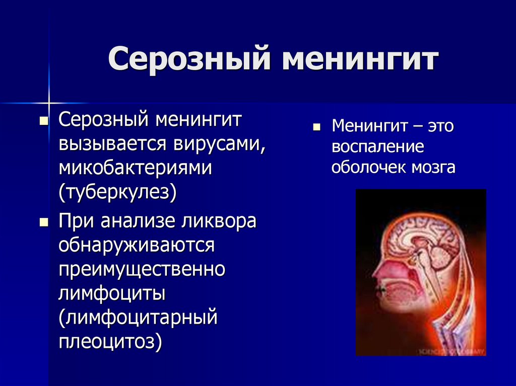 Серозный менингит