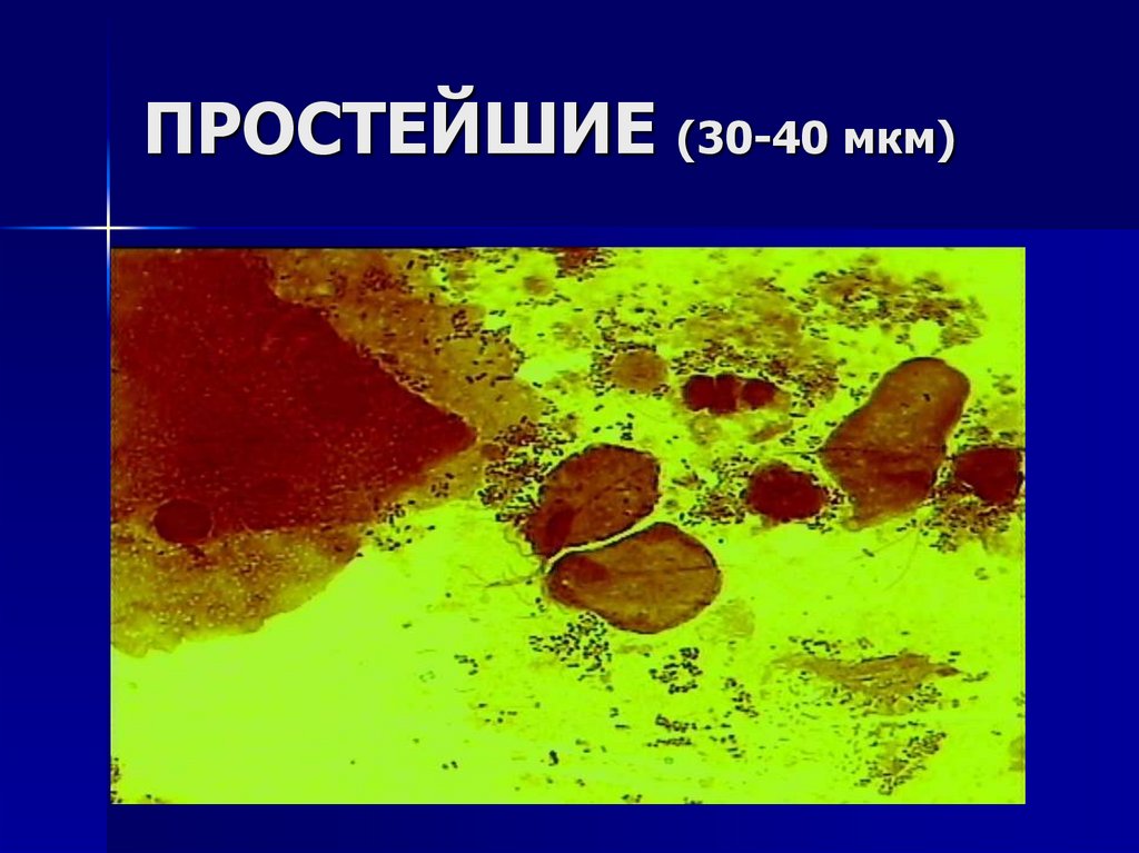 ПРОСТЕЙШИЕ (30-40 мкм)