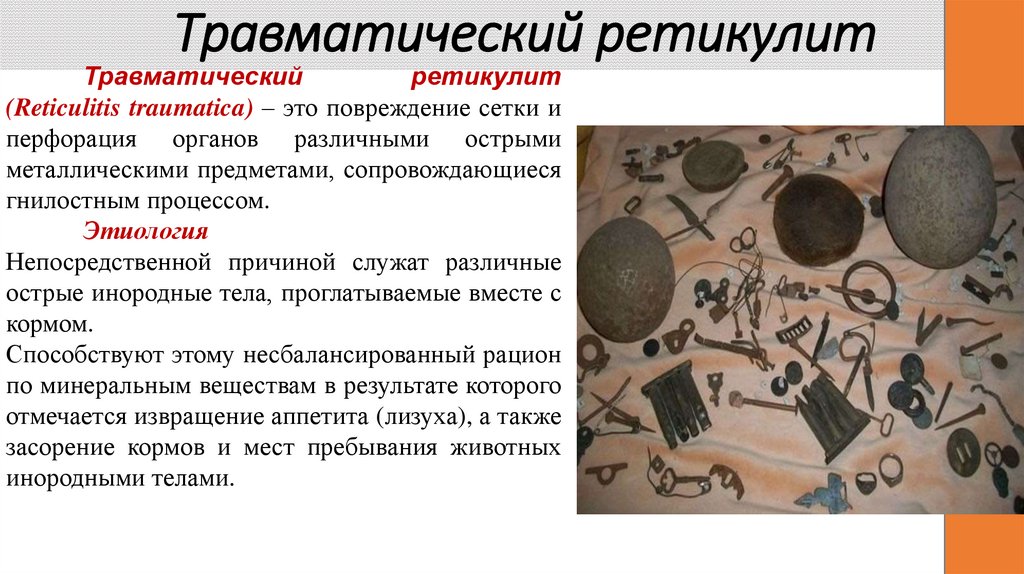 Травматический ретикулит