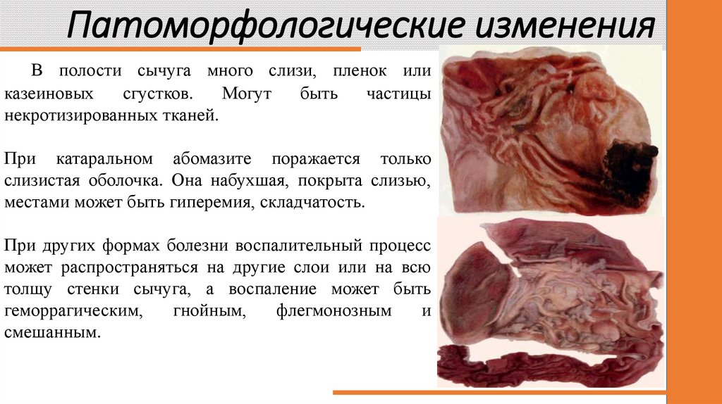 Патоморфологические изменения