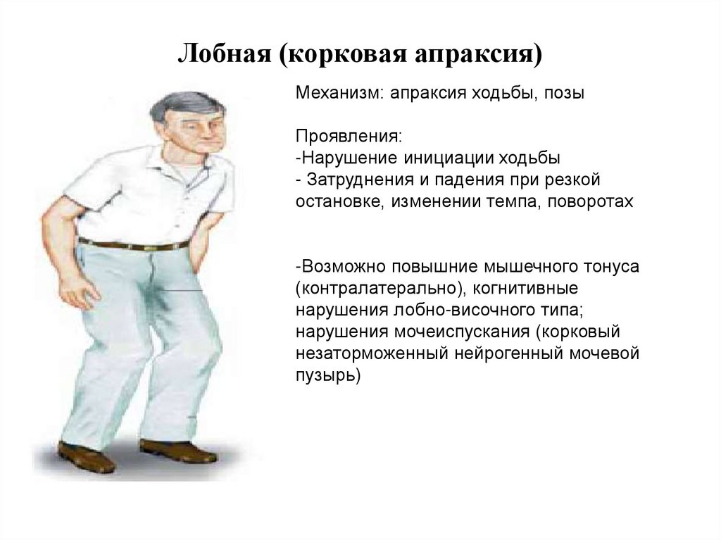 Лобная (корковая апраксия)