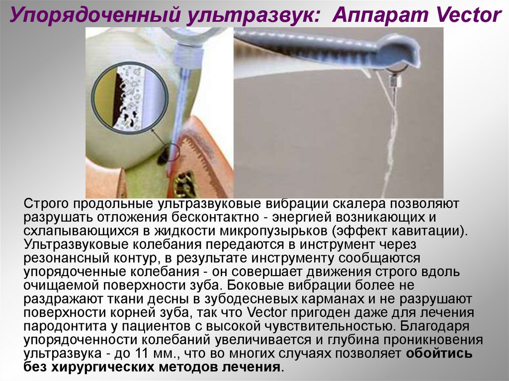 Упорядоченный ультразвук: Аппарат Vector