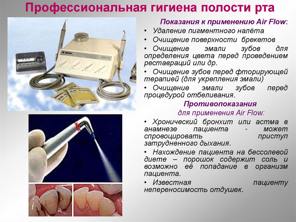 Профессиональная гигиена полости рта